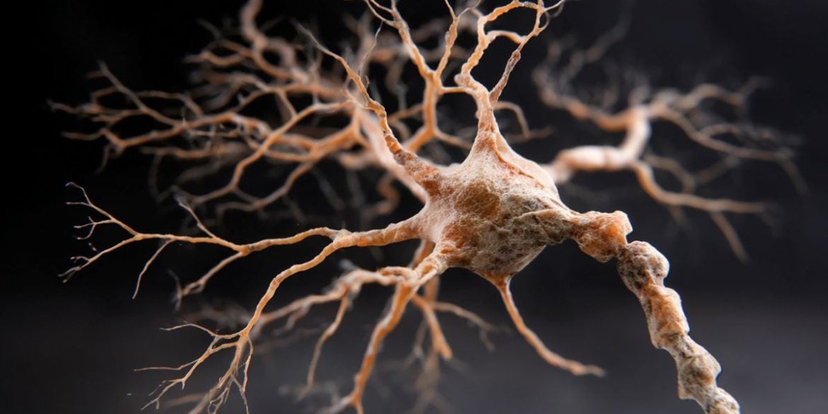 This shows a neuron.