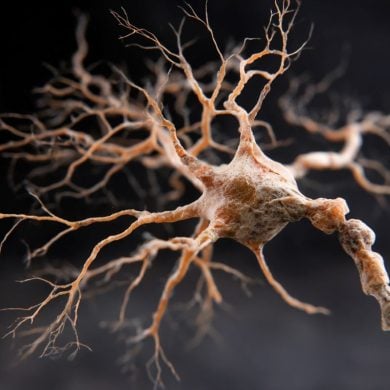 This shows a neuron.