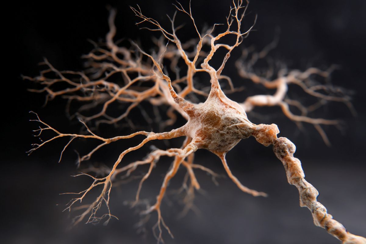 This shows a neuron.