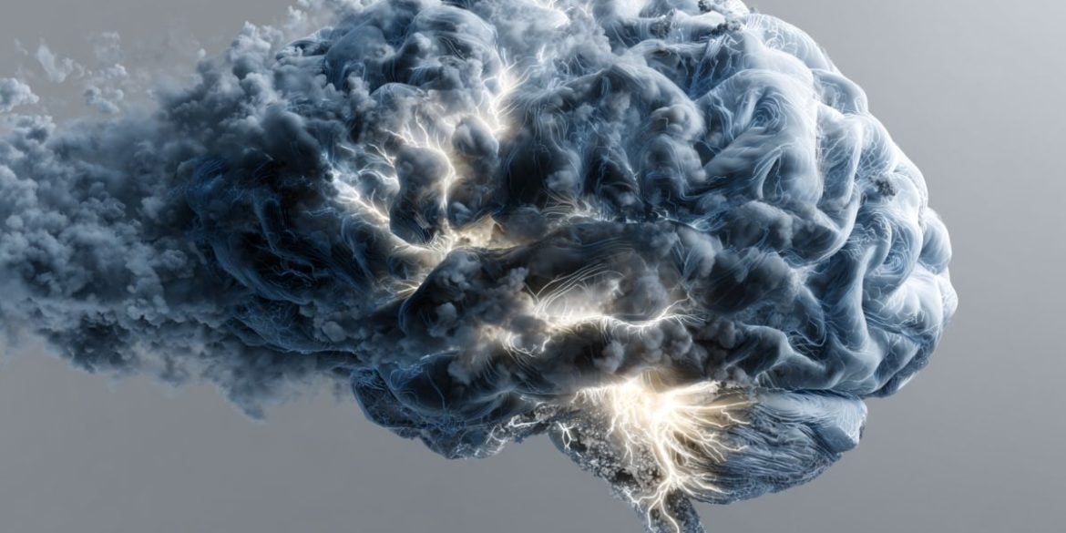 This shows a brain.