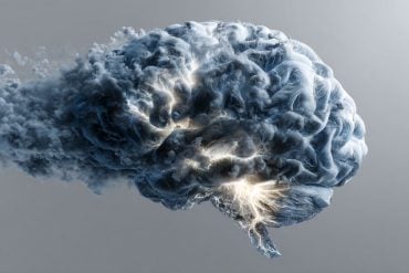 This shows a brain.