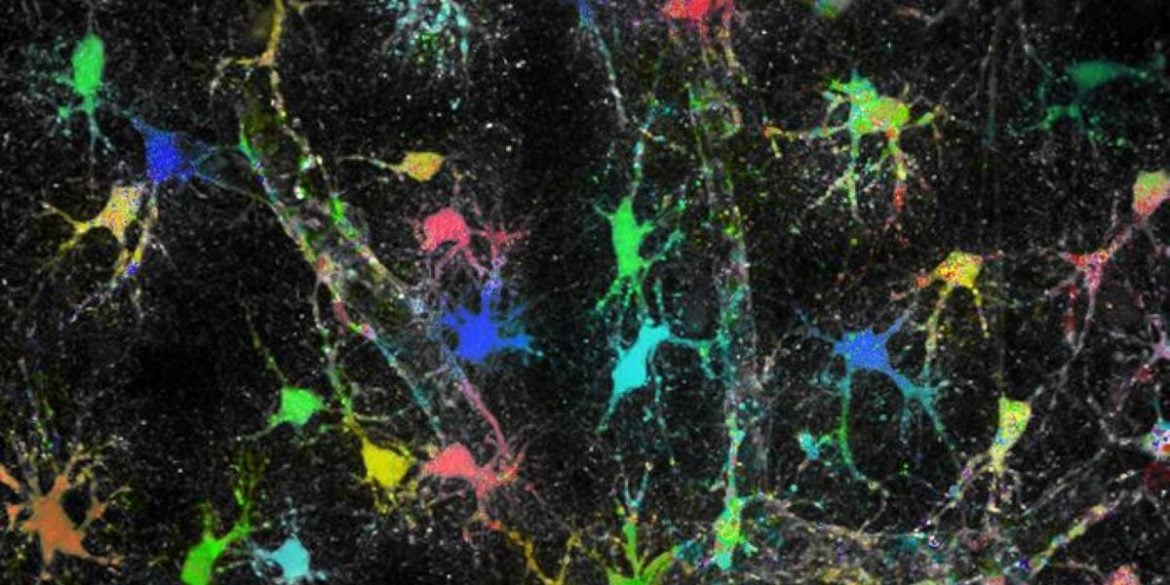 This shows astrocytes in brain tissue.