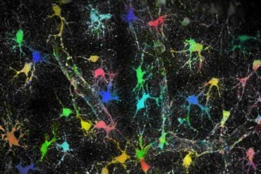 This shows astrocytes in brain tissue.