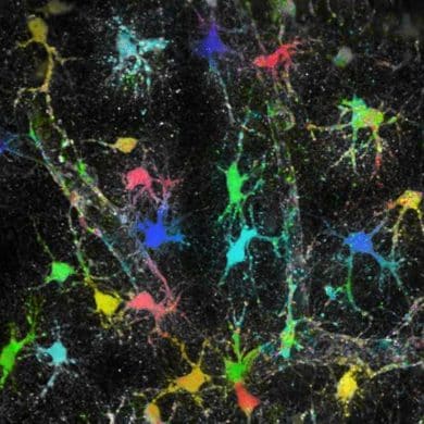 This shows astrocytes in brain tissue.