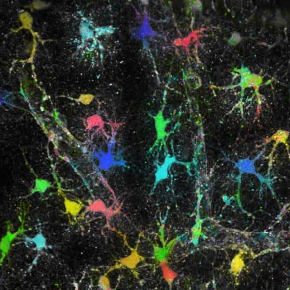 This shows astrocytes in brain tissue.