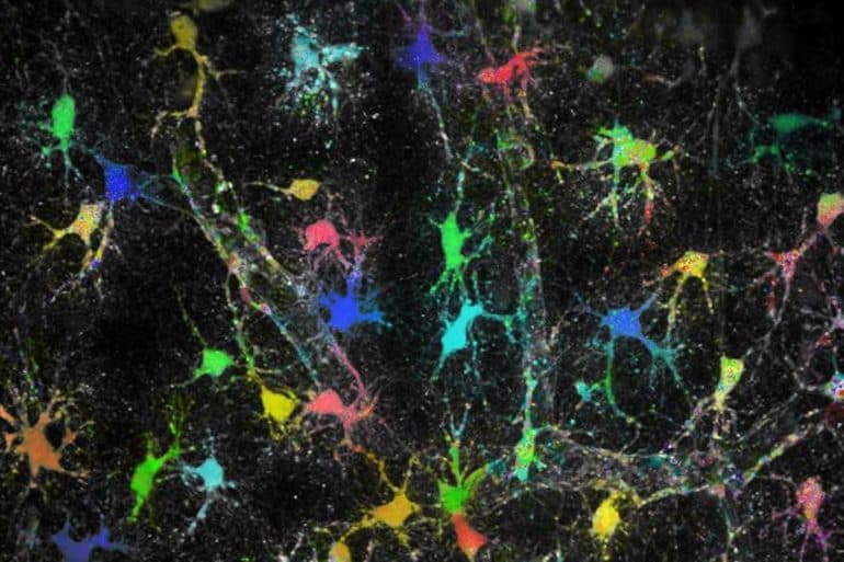 This shows astrocytes in brain tissue.