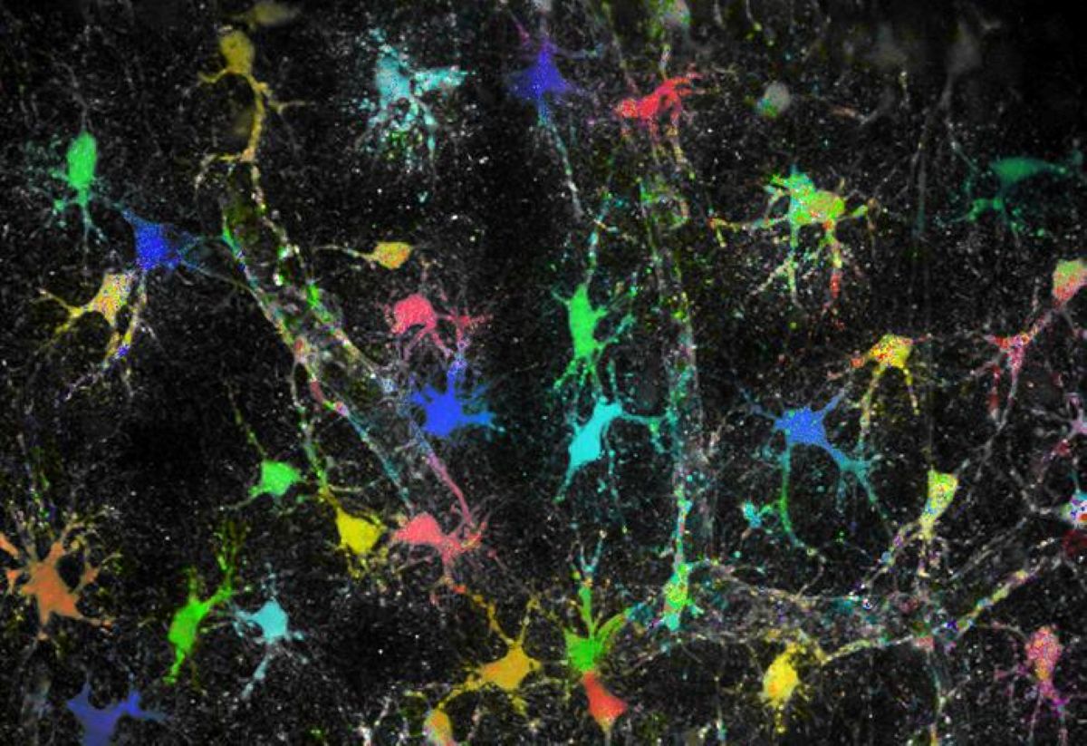This shows astrocytes in brain tissue.