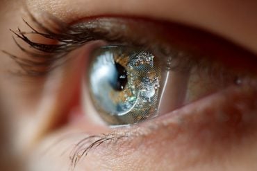 This shows a woman with a digital contact lense on her eye.