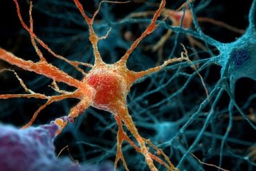 This shows neurons.