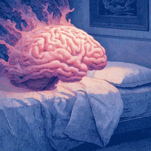 This shows a brain on a bed.