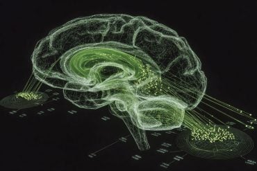 This shows a brain.