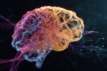 This shows a brain.