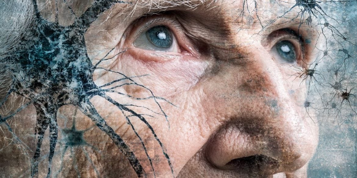 This shows an older man and neurons.