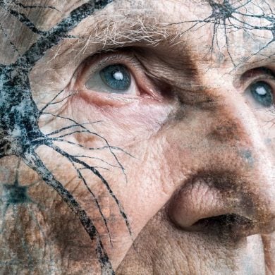 This shows an older man and neurons.