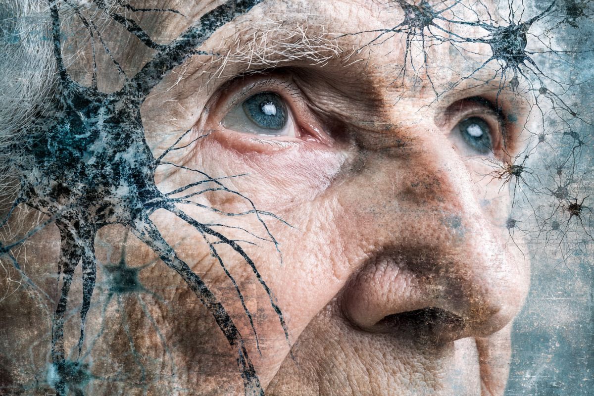 This shows an older man and neurons.