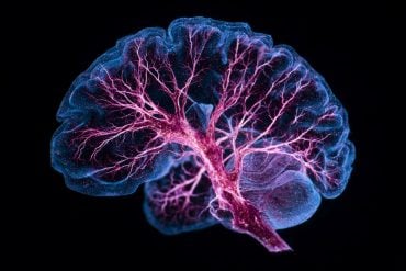 This shows a brain.