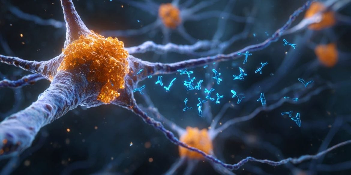 This shows neurons.