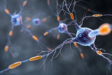 This shows neurons.