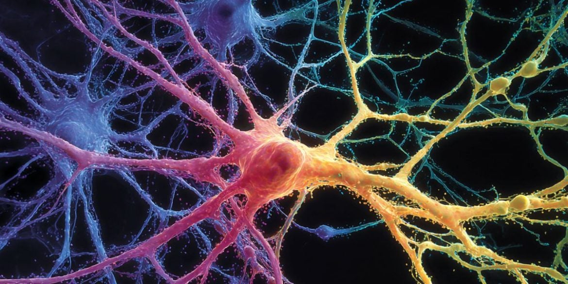 This shows neurons.