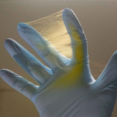 This shows the mesh used in this glioblastoma study.