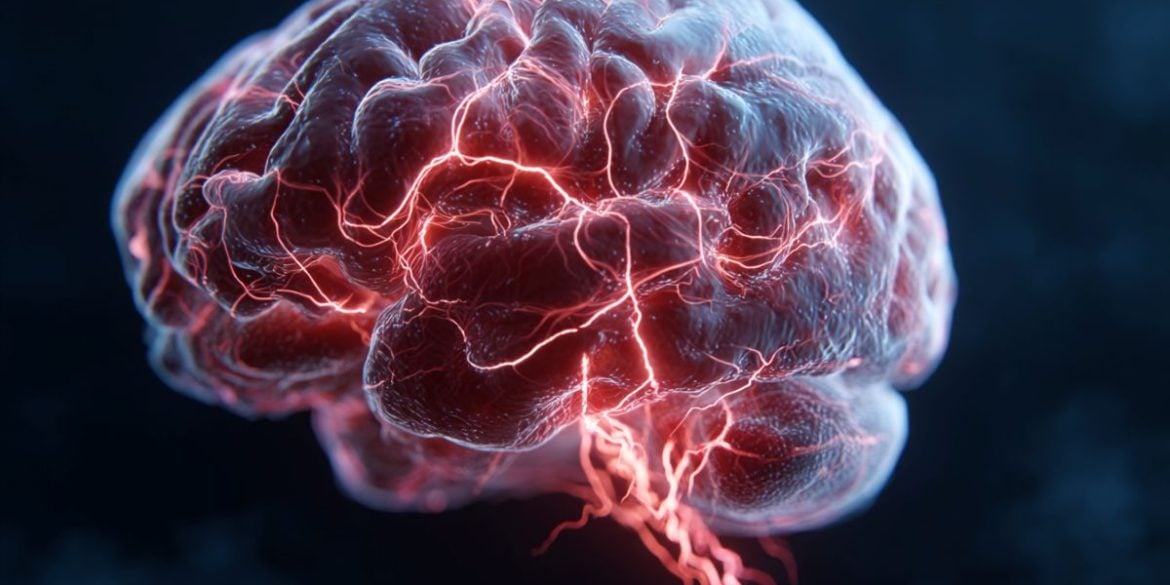 This shows a brain.
