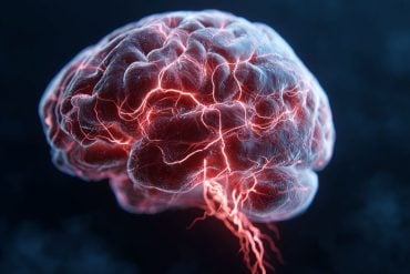This shows a brain.