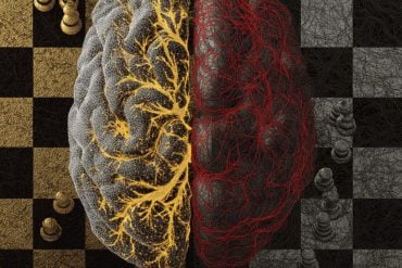 This shows a brain on a chessboard.