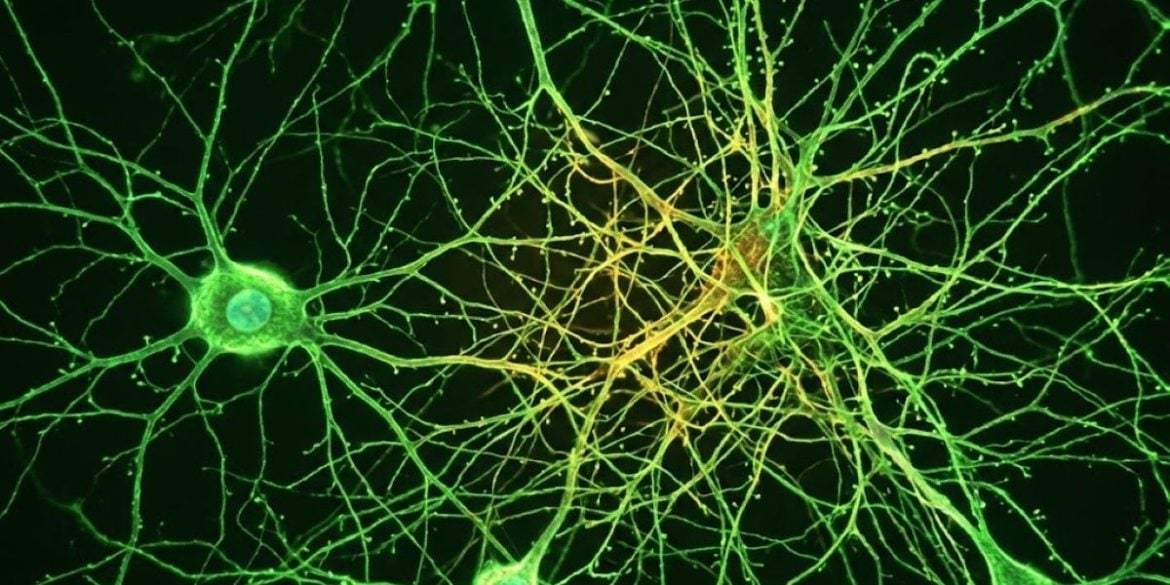 This shows neurons.