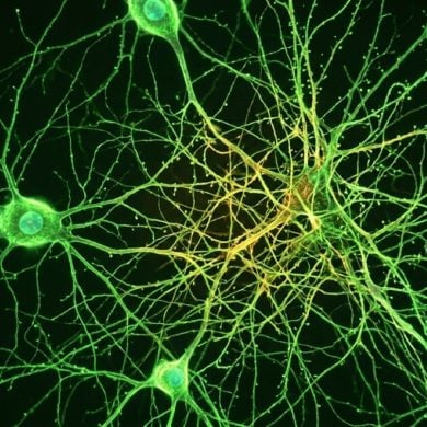 This shows neurons.