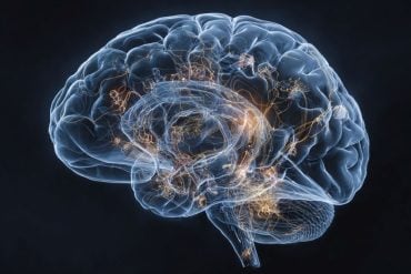 This shows a brain.