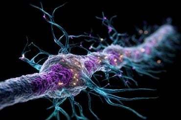 This shows an axon.