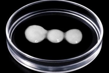 This shows spinal cord cells in a petri dish.