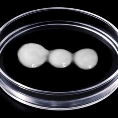 This shows spinal cord cells in a petri dish.