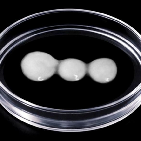 This shows spinal cord cells in a petri dish.