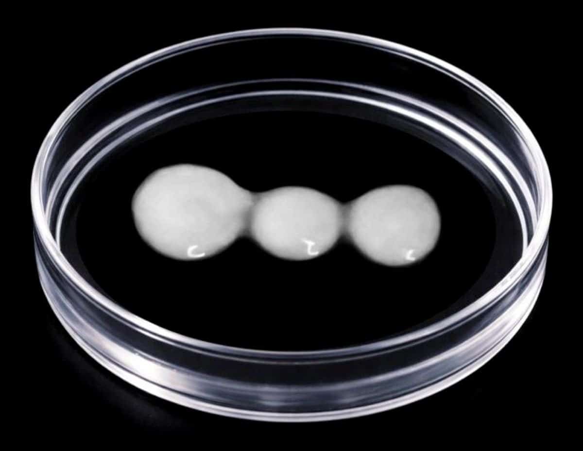 This shows spinal cord cells in a petri dish.