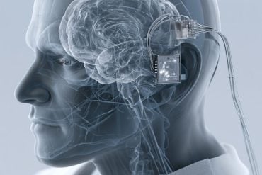 This shows a brain and a BCI chip.