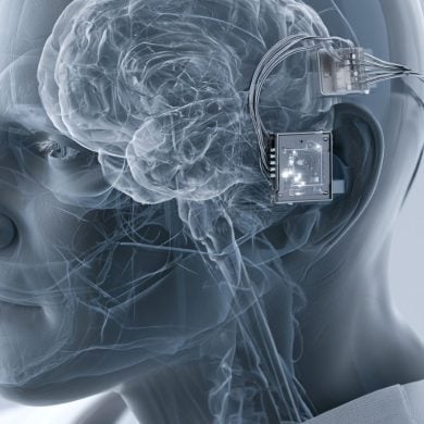 This shows a brain and a BCI chip.
