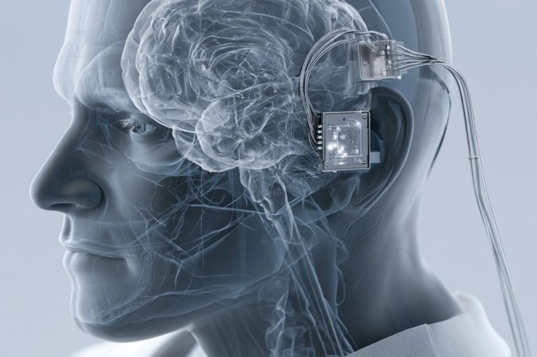 This shows a brain and a BCI chip.