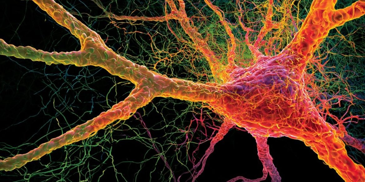 This shows a neuron.