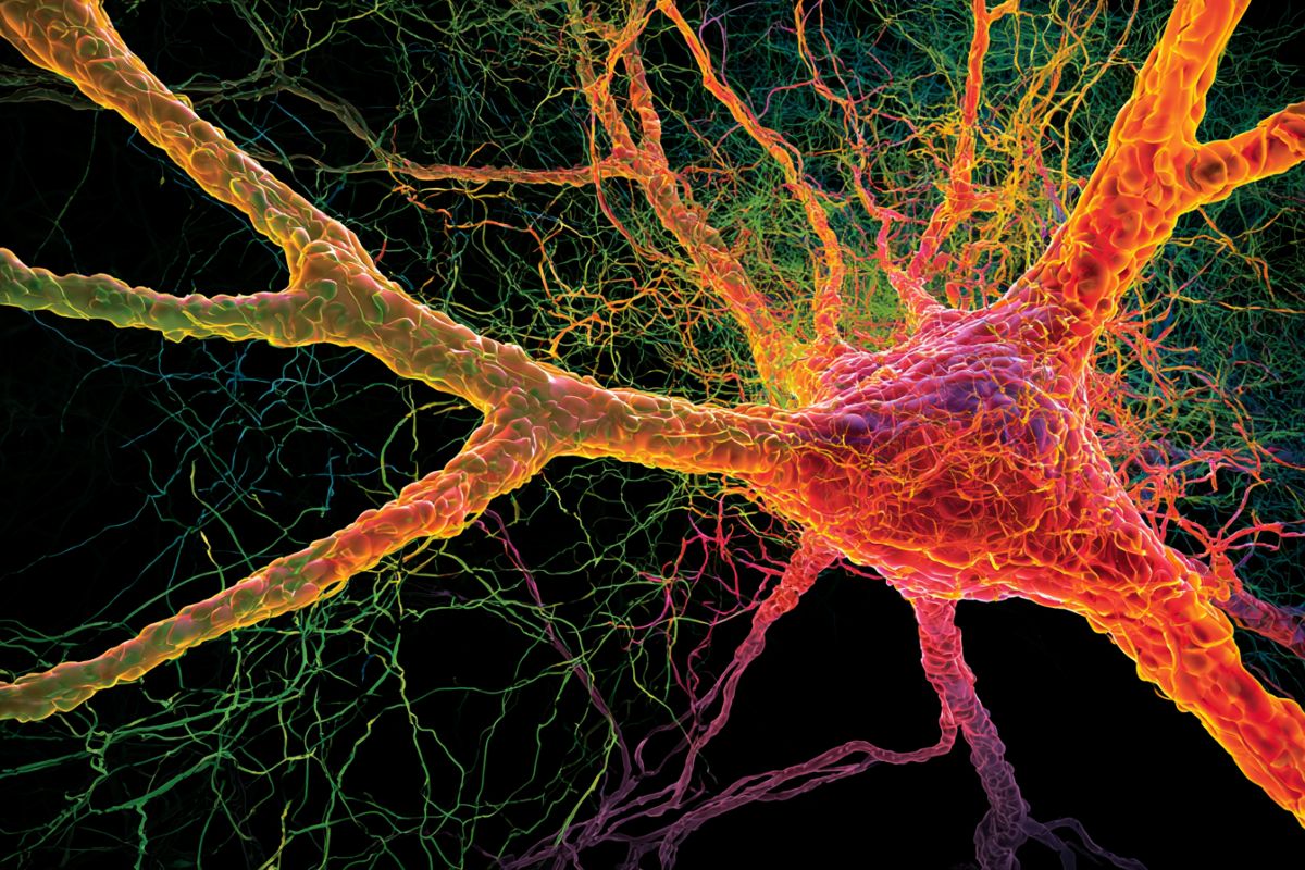This shows a neuron.