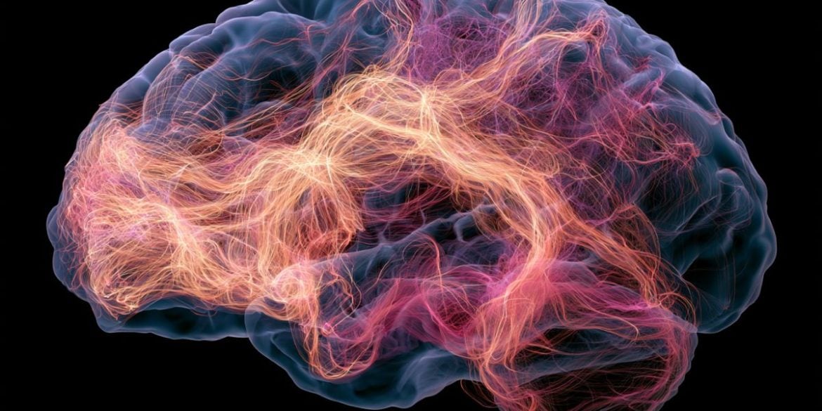 This shows a brain.