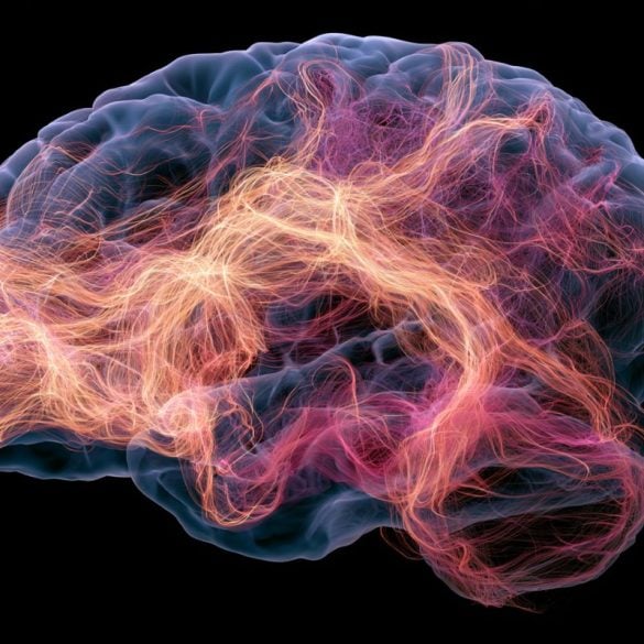 This shows a brain.