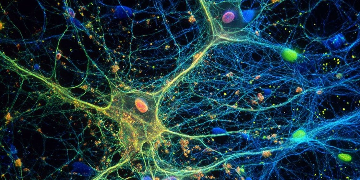 This shows astrocytes.