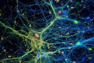 This shows astrocytes.