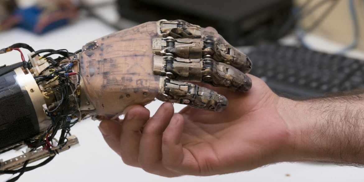 This shows a bionic hand.