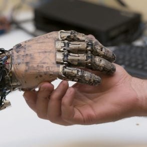 This shows a bionic hand.