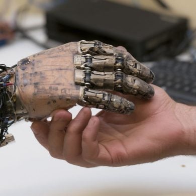 This shows a bionic hand.