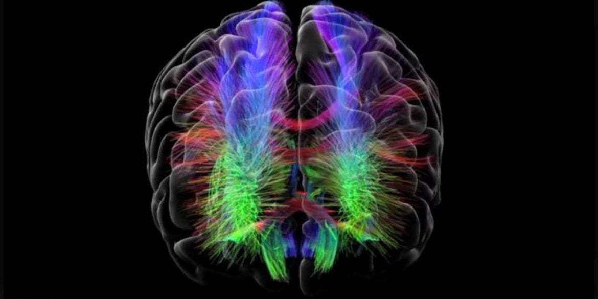 This shows a brain scan from the study.
