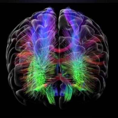 This shows a brain scan from the study.