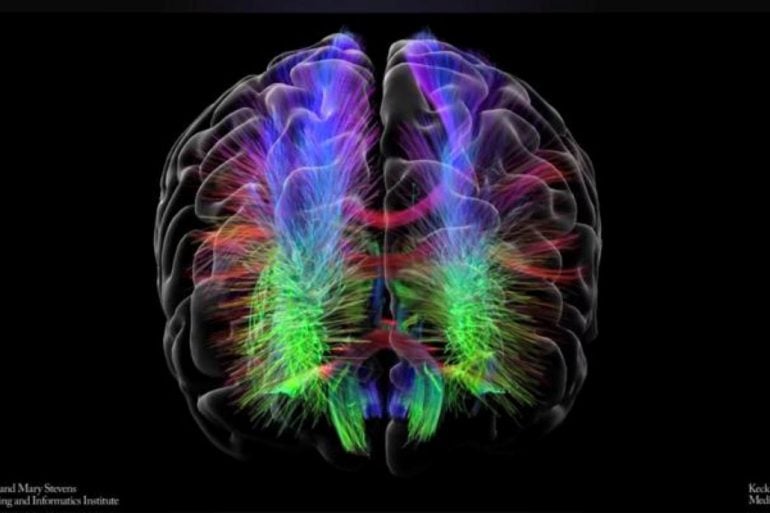 This shows a brain scan from the study.